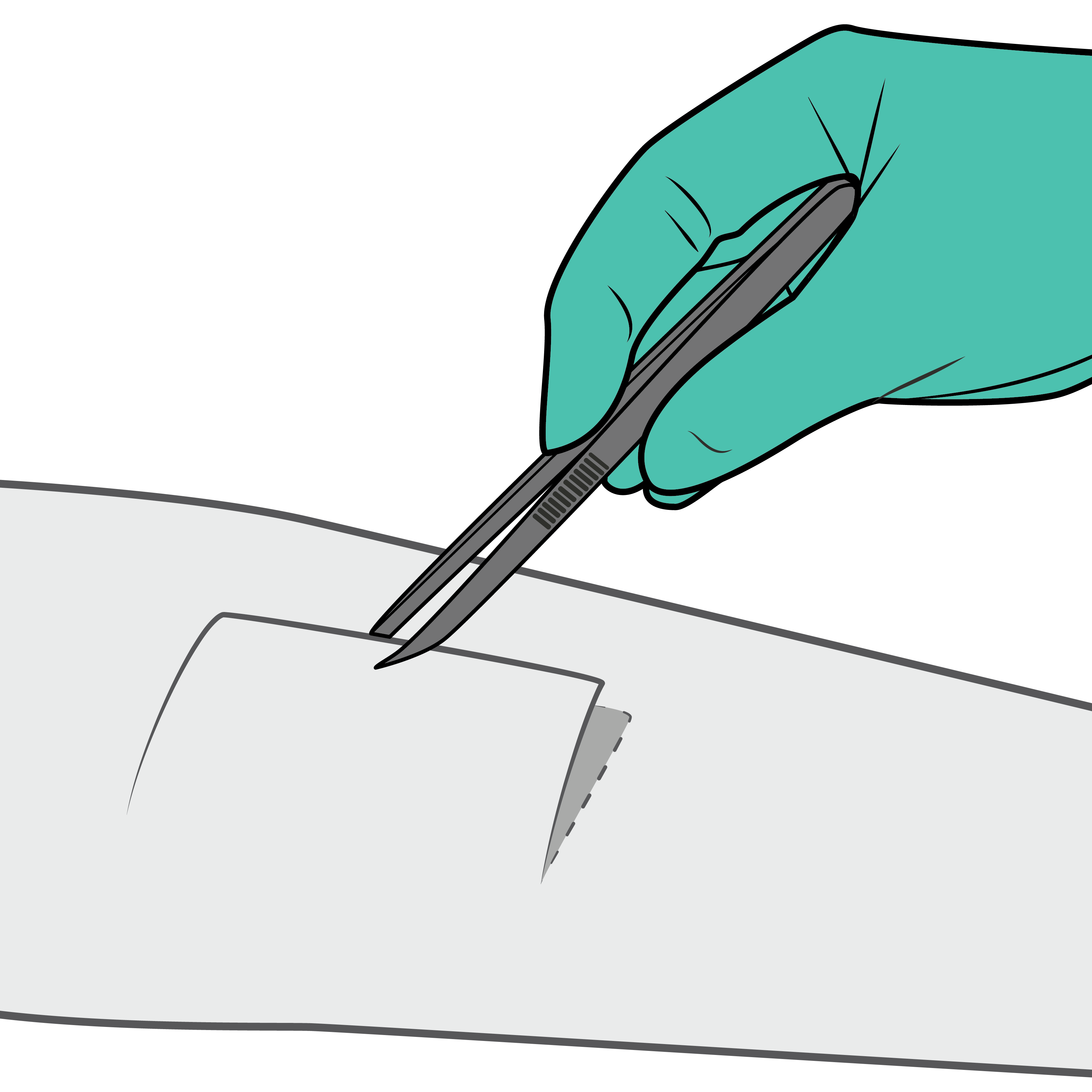 Close-up of a gloved hand using tweezers to lift a small rectangular sample from a flat surface during a medical or laboratory procedure.