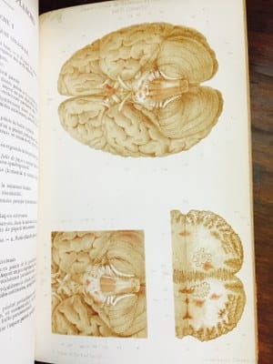 J.M. Charcot - Leçons sur les maladies du système nerveux faites a la Saltpétriere