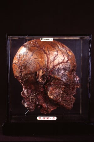 Swan 2: rcshm-d816-5 head