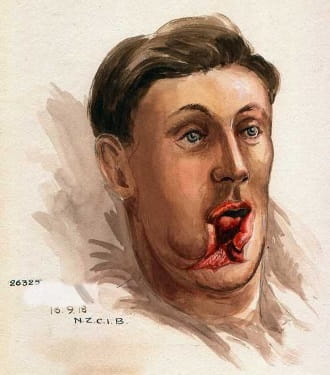 History Day, Gillies: 1 - before