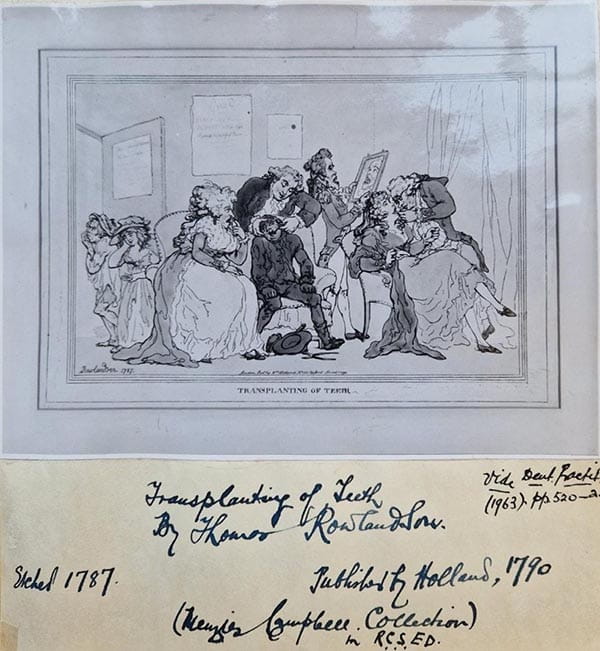 An album page containing a drawing, described in the main text of this post, entitled 'Transplanting of Teeth'. The page is captioned 'Transplanting of Teeth by Thomas RowlandsonSketched 1787. Published by Holland, 1790. (Menzies Campbell Collection in RCSEd.)'