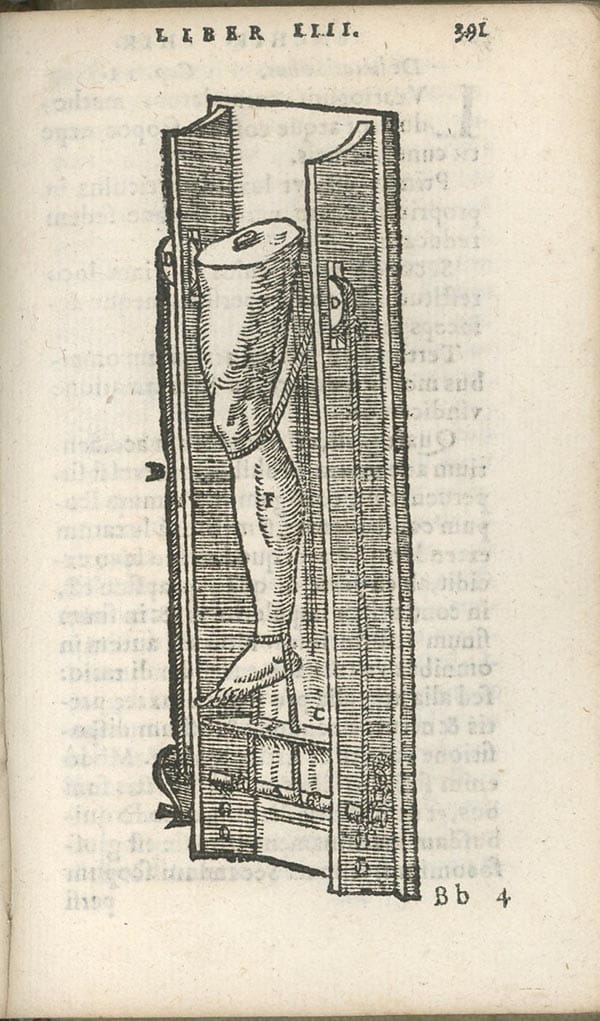 A drawing of a device resembling a torture rack, with a leg (severed for clarity) strapped in to it.