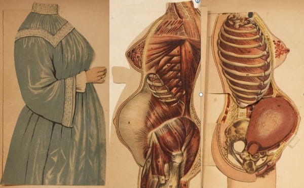 Under your skin 6: Solis-Cohen