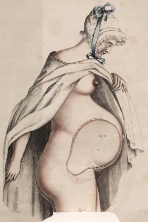 Under your skin 3: Spratt