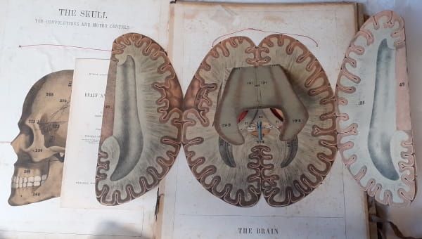 Under your skin 5: Witkowski brain