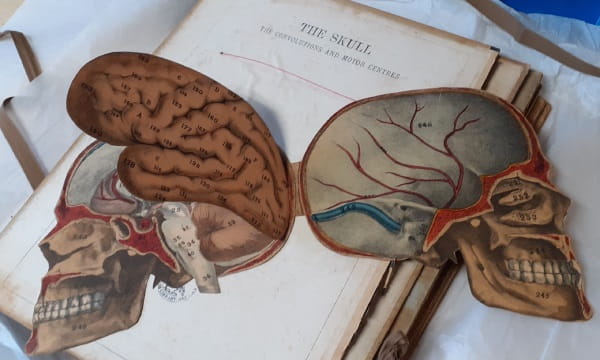 Under your skin 4: Witkowski skull