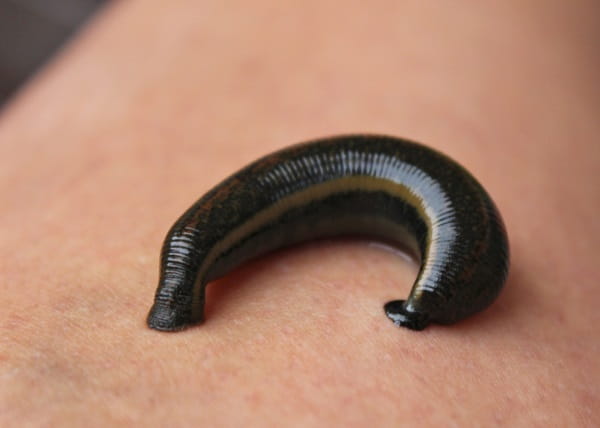 Leeches 1: Hirudo medicinalis